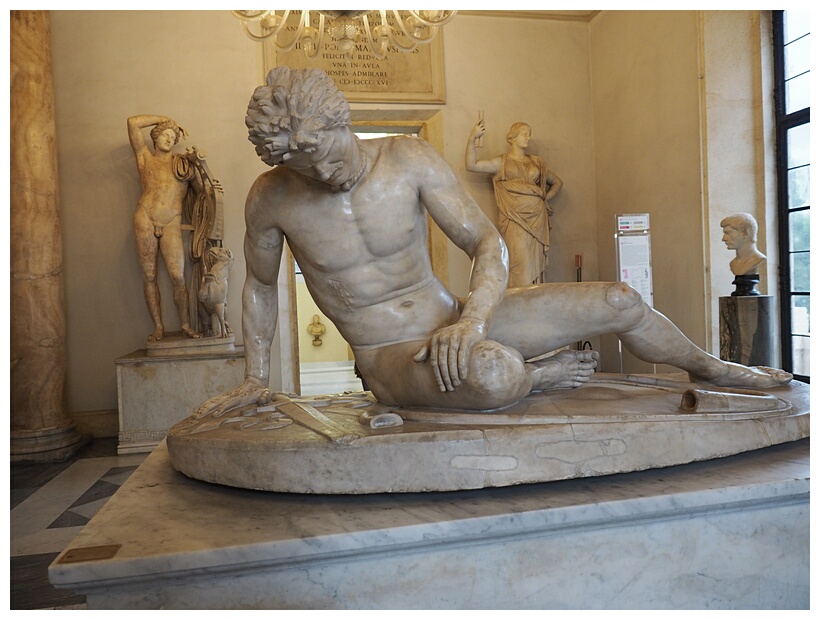Dying Gaul