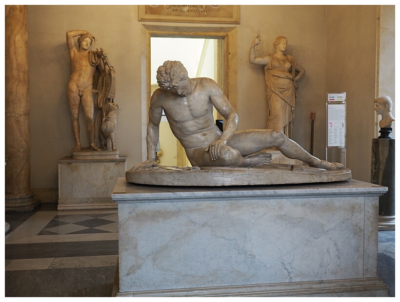 Dying Gaul