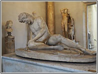 Dying Gaul