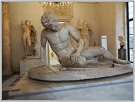 Dying Gaul
